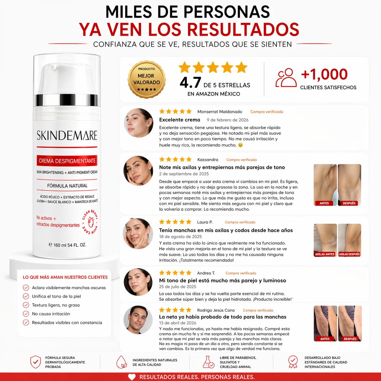 Crema Aclaradora Para Zonas Íntimas | Despigmentante 120ml SkinDemare